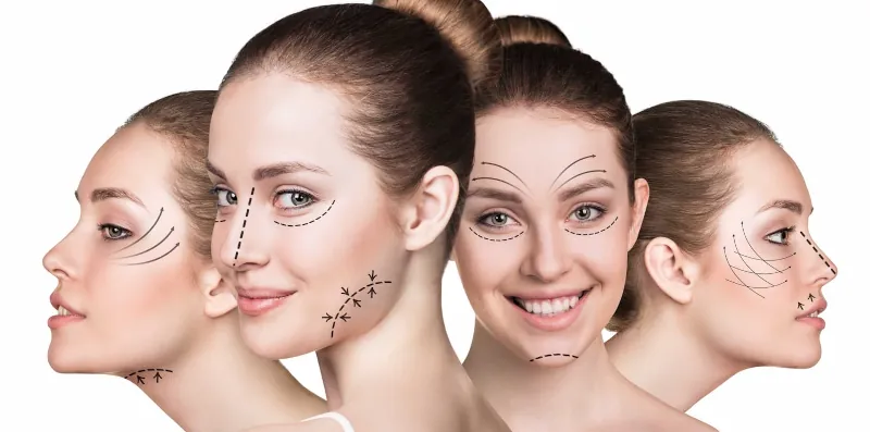 Armonización Orofacial